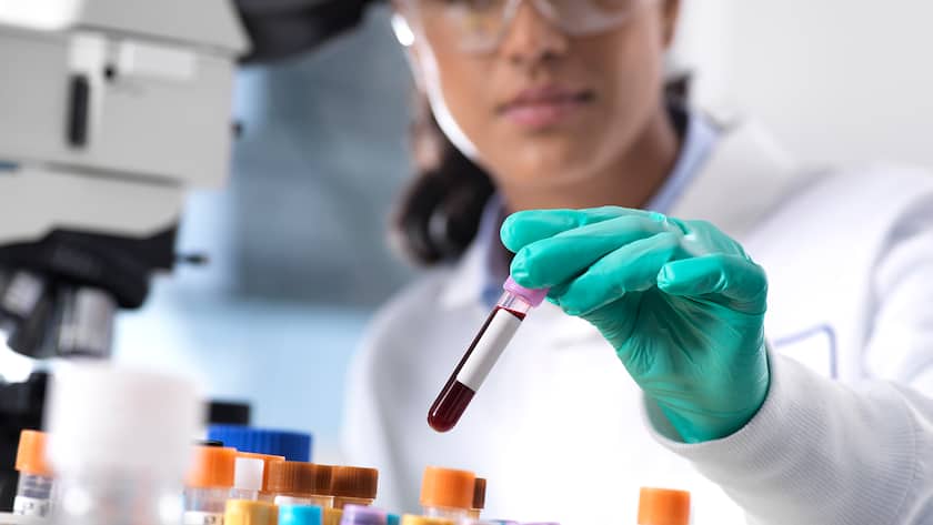 Eine Laborantin untersucht eine Blutprobe.