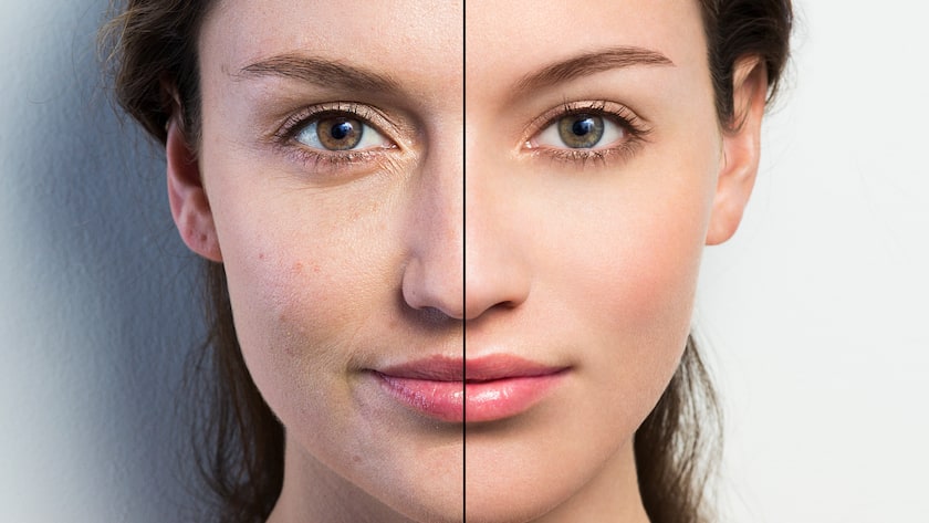 Gesicht mit Filter und ohne