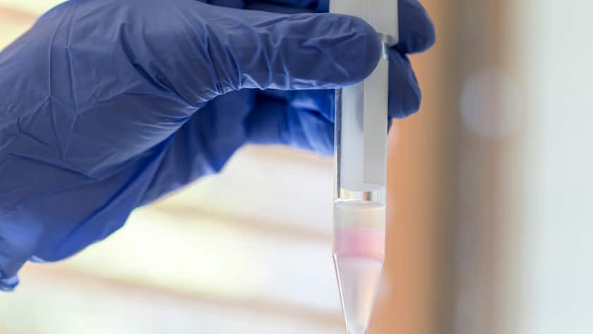 Die Spermienqualität in der Schweiz unterscheidet sich je nach Wohnort. (Archivbild)