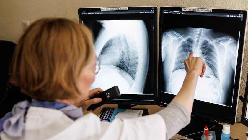 Eine Radiologin analysiert in ihrem Büro die Röntgenbilder einer Lunge.