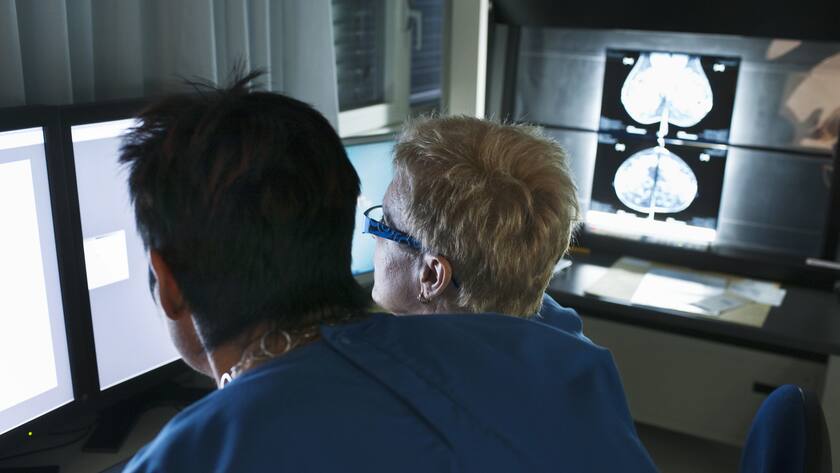 KI Bilderkennung, Mammografie