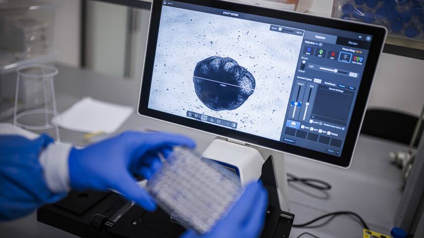 Theo Ribierre, coordinateur scientifique, observe un organoide, modeles biologique entre le cellule et l'organe complet, a l'occasion de l'inauguration de la plateforme "NeuroNA" de neurosciences cellulaires humaines, ce lundi 24 avril 2024 au Campus Biotech a Geneve