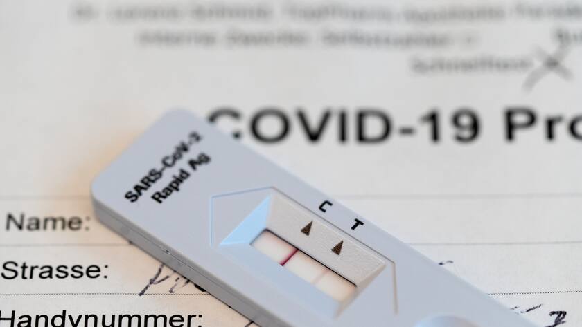 Ein positives Testresultat (zwei Streifen) auf dem Teststreifen eines Covid-19 Antigen-Schnelltests, fotografiert in der TopPharm Apotheke am Paradeplatz am 3. November 2020 in Zuerich. (KEYSTONE/Gaetan Bally)