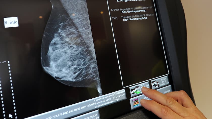 Mammografie: Ein Novartis Medikament verlängert das Leben von Brustkrebs-Patientinnen.
