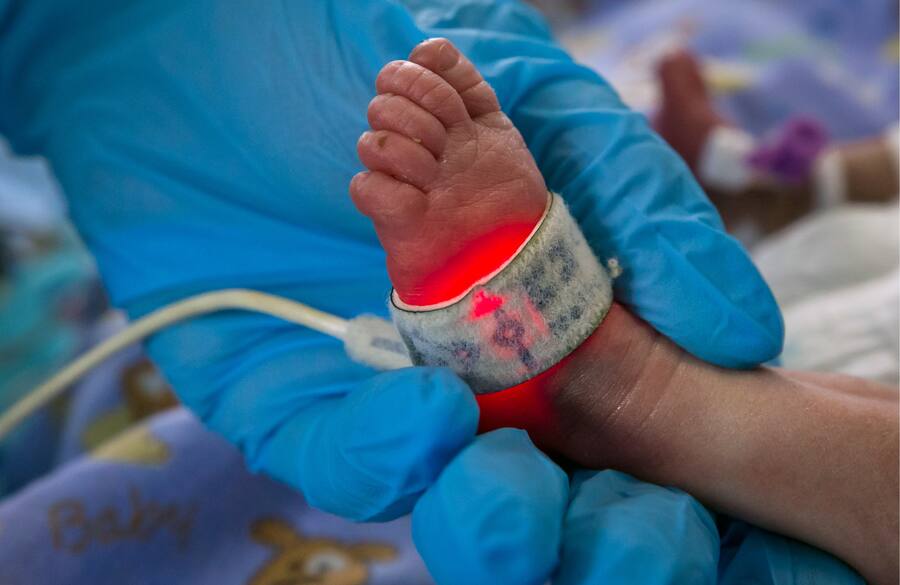 SIMFEROPOL, RUSSIA - FEBRUARY 27, 2019: A newborn in the intensive care unit of the perinatal centre at Semashko Crimean Republican Hospital in Simferopol, Crimea. Sergei Malgavko/TASS (Photo by Sergei Malgavko\TASS via Getty Images)