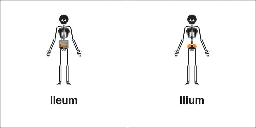 Eine Illustration veranschaulicht die Homophone «ileum» und «Ilium».